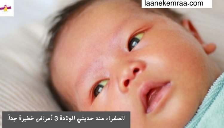 الصفراء عند حديثي الولادة 3 أعراض خطيرة جداً