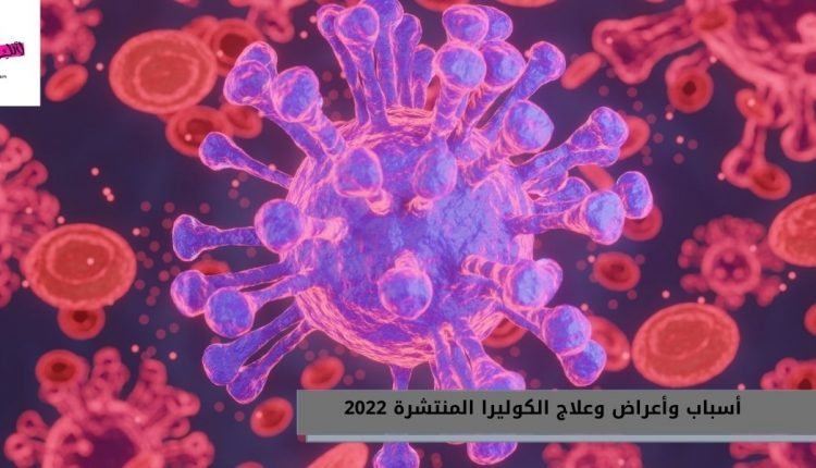 أسباب وأعراض وعلاج الكوليرا المنتشرة 2022